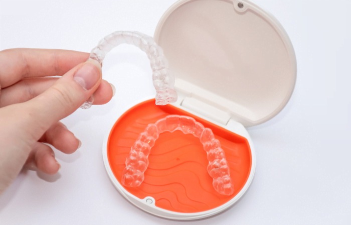 Magic of Invisible Aligners